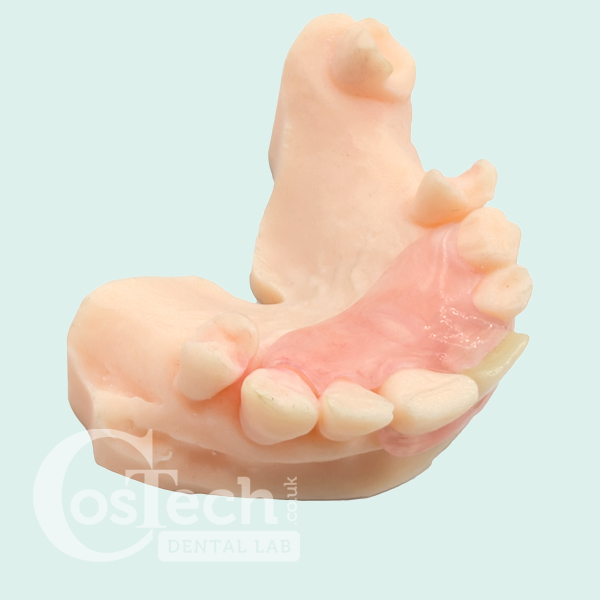 Demo Model – Flexible Partial Denture