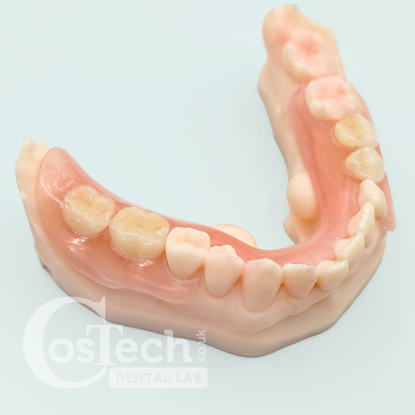 Demo Model – Flexible Partial Denture